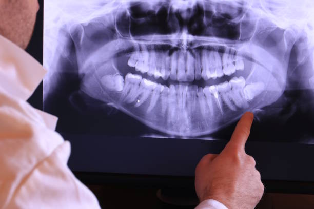 Best Teeth Whitening  in Grand Ledge, MI